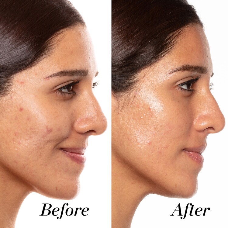 A+ - Sérum ultraconcentrado con retinoides