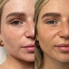 The product image is missing!