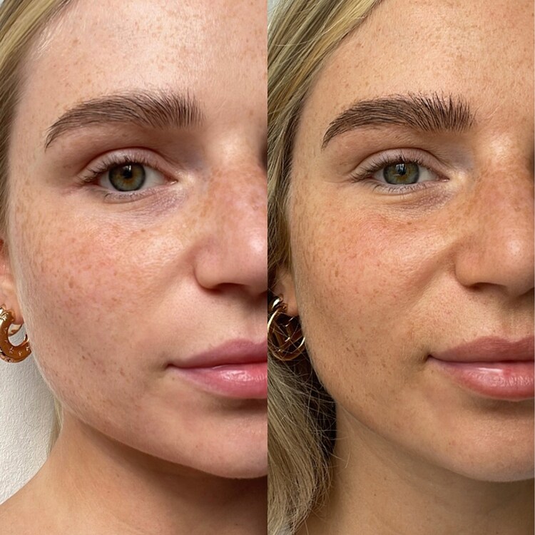 THE FACE - Gotas autobronceadoras