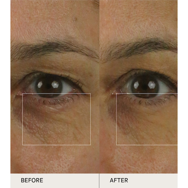  The Brightening Eye Cream - Koyu Halka Karşıtı Aydınlatıcı Göz Kremi