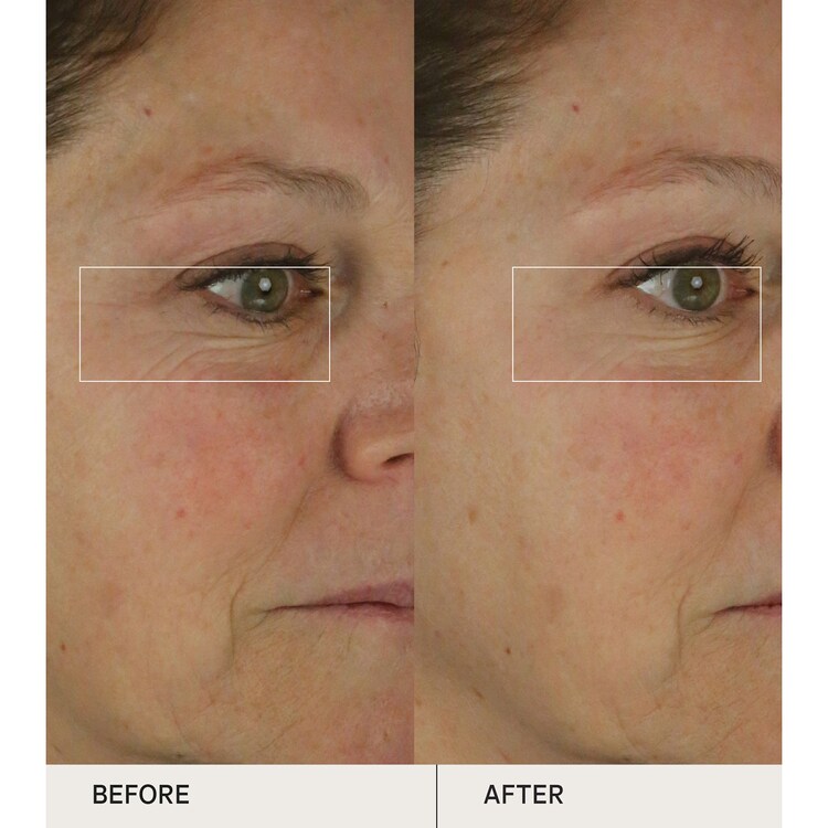 The Dewy Skin Cream - Rig og udfyldende fugtighedscreme i rejsestørrelse