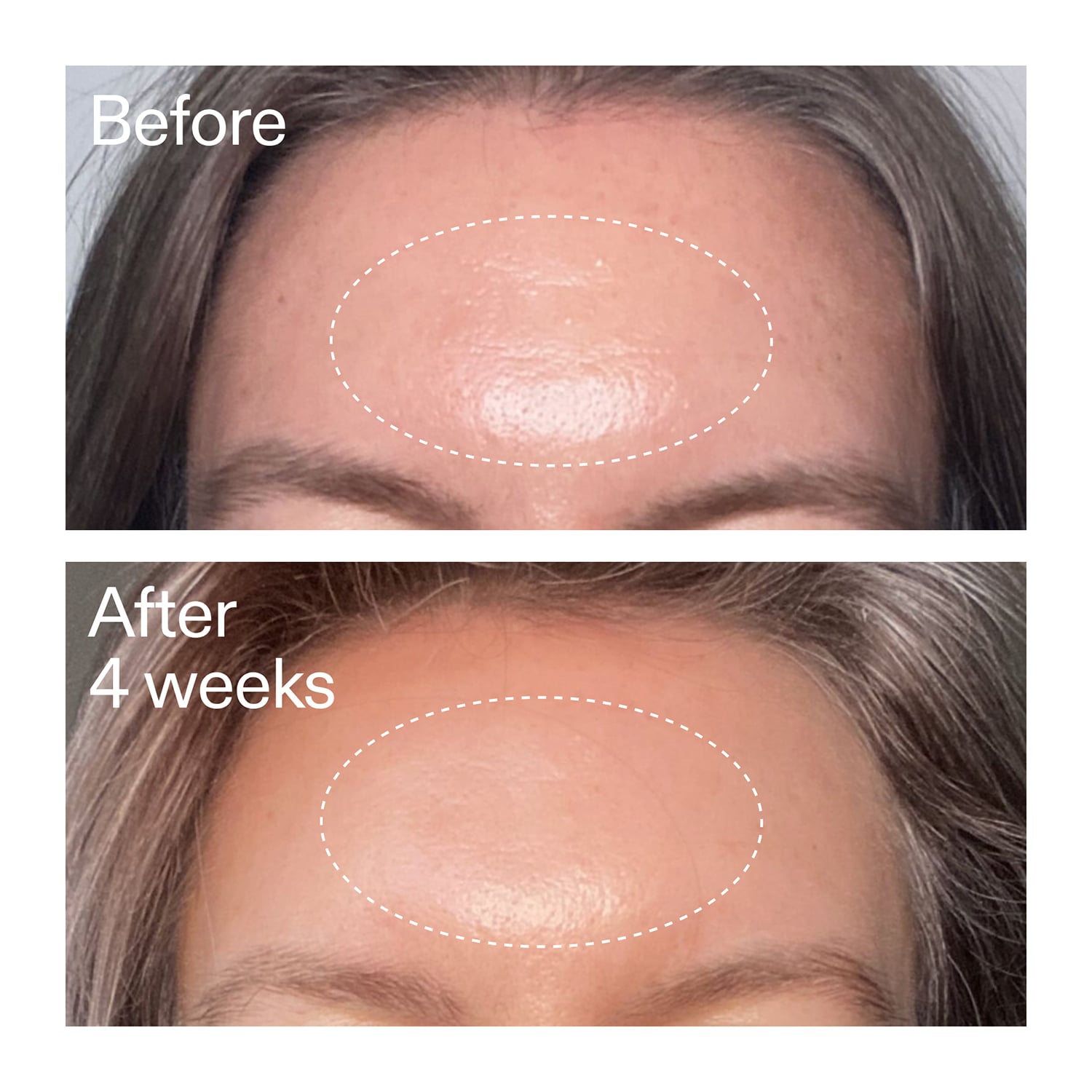 Advanced Retinal Serum