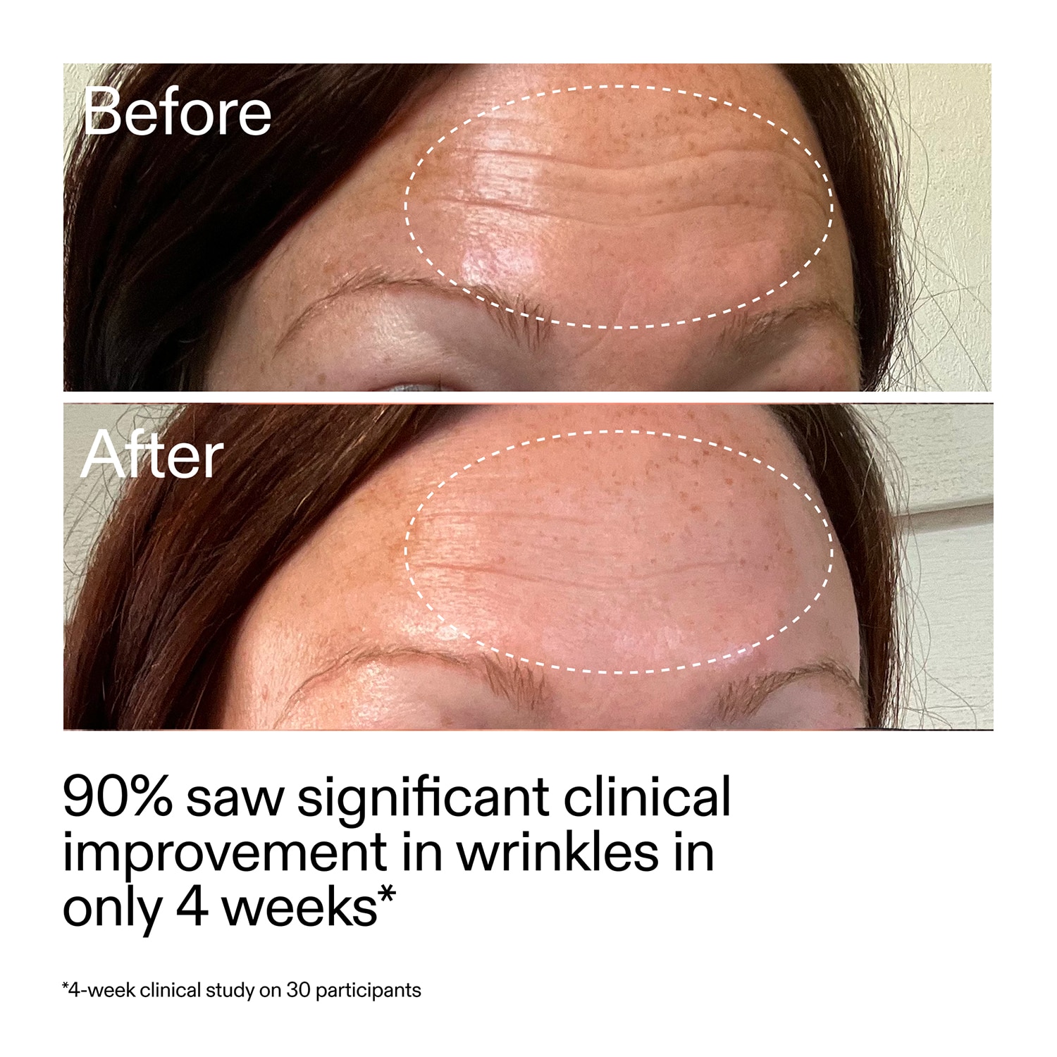 Starter Retinol Serum