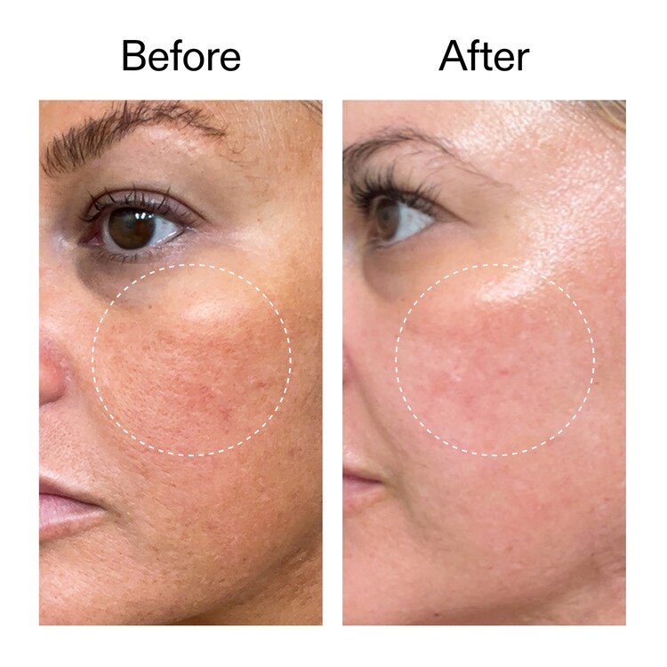 Starter Retinol Serum - Sérum Rétinol d'Initiation