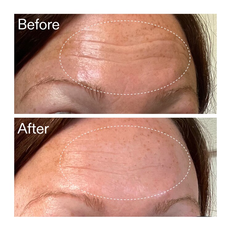 Starter Retinol Serum - Sérum Rétinol d'Initiation