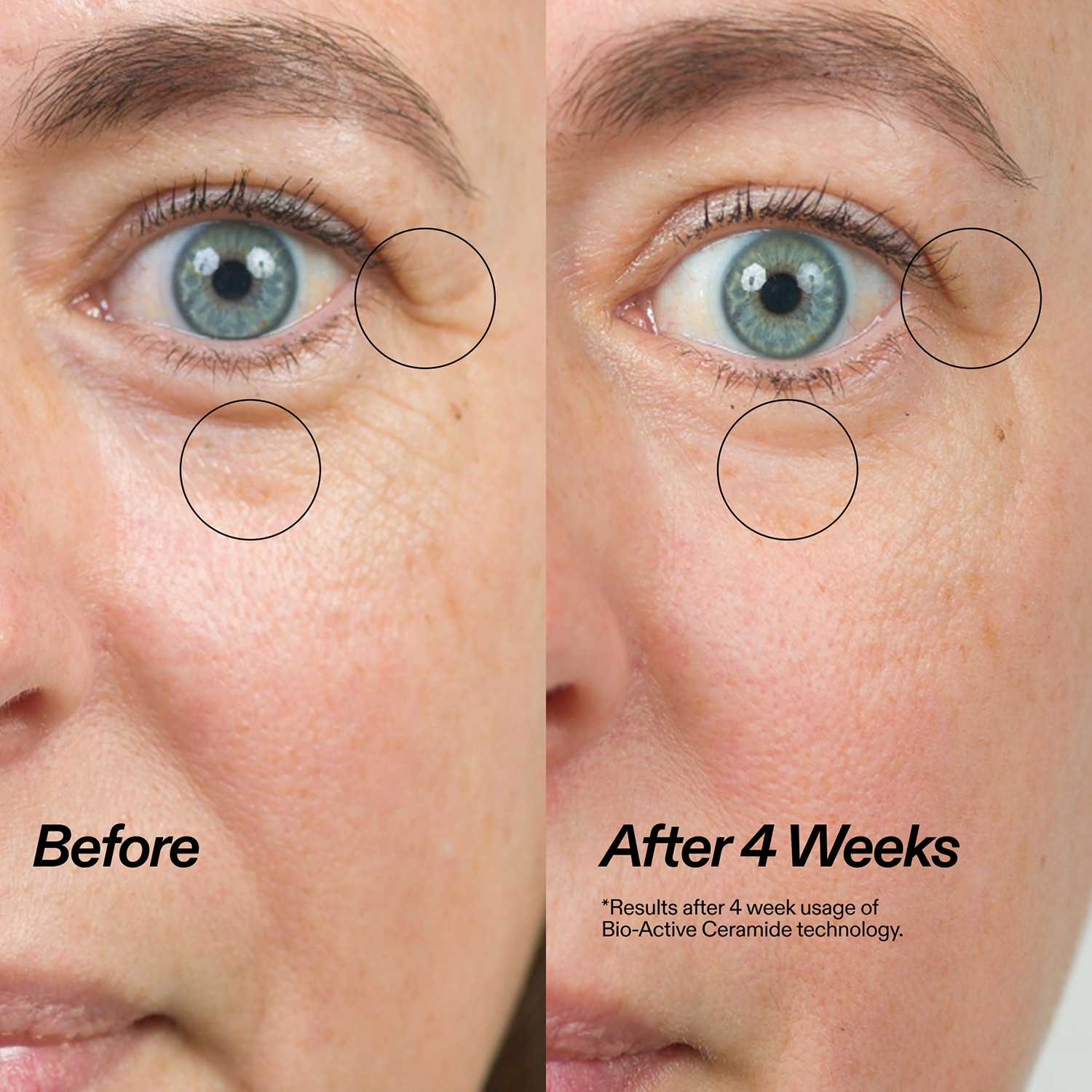 Bio-active Ceramide Eye Cream