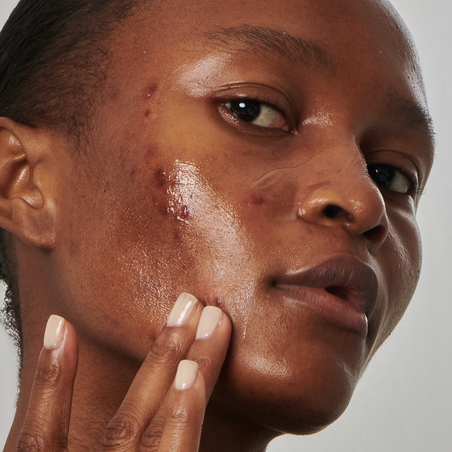 Excess oil solution with 20% niacinamide - Yüz Serumu | THE INKEY