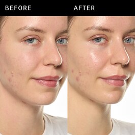 Ectoin Hydro-Barrier Serum - Hidratantni i za&scaron;titni serum