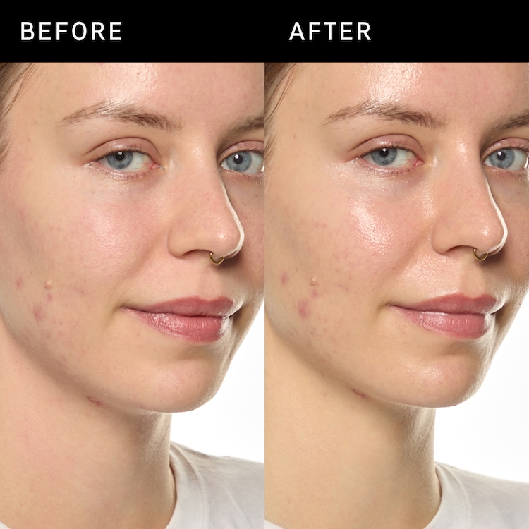 Ectoin Hydro-Barrier Serum - Återfuktande och skyddande serum