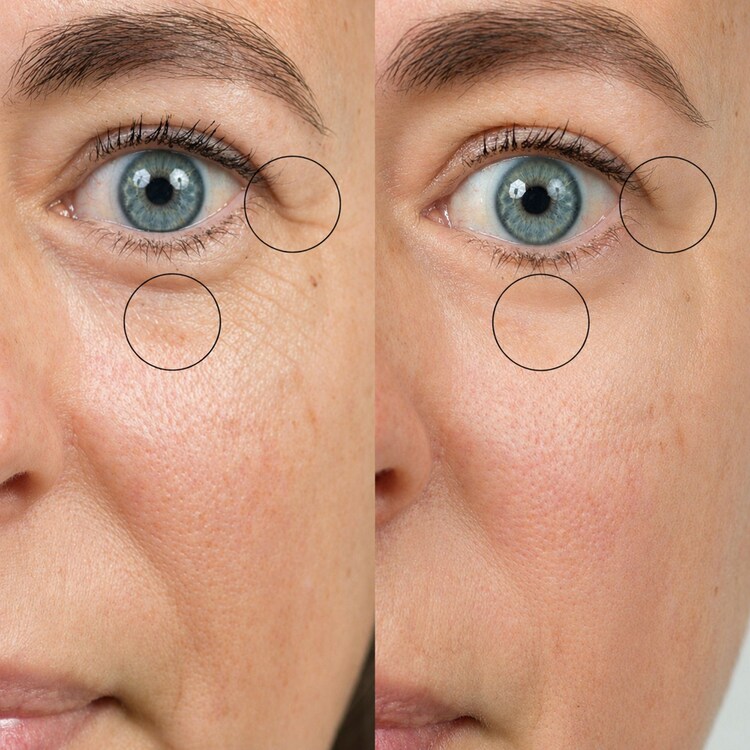 Bio-active Ceramide Eye Cream - Creme contorno dos olhos c/ ceramidas bioativas