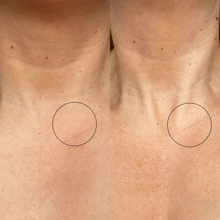 Bio-active Ceramide Neck Stick - Stick para o pescoço com ceramida bioativa