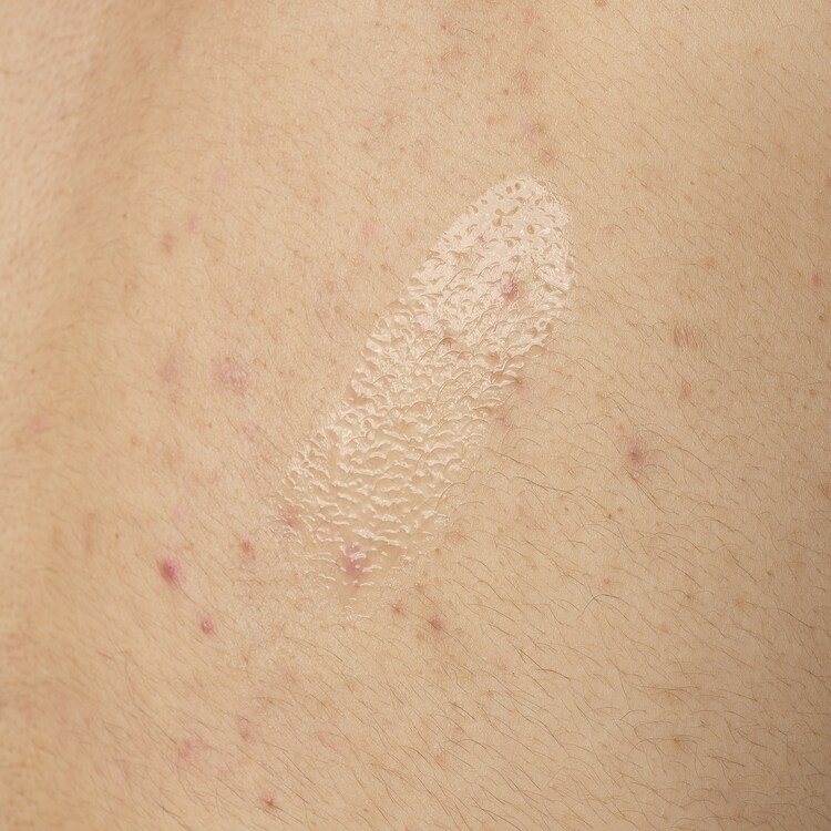 Ser de corp cu  acid salicilic 0,5 %  - Ser de corp, anti-imperfectiuni