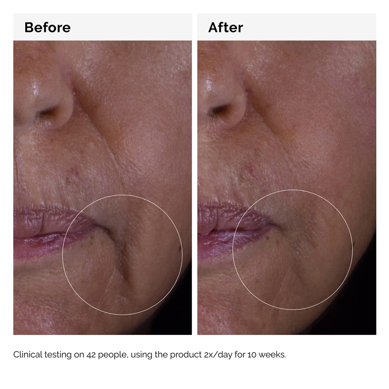 Growth Factors Solution 15% - Anti-aging Serum