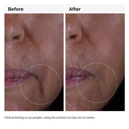 GF 15% Solution - Serum protiv starenja kože