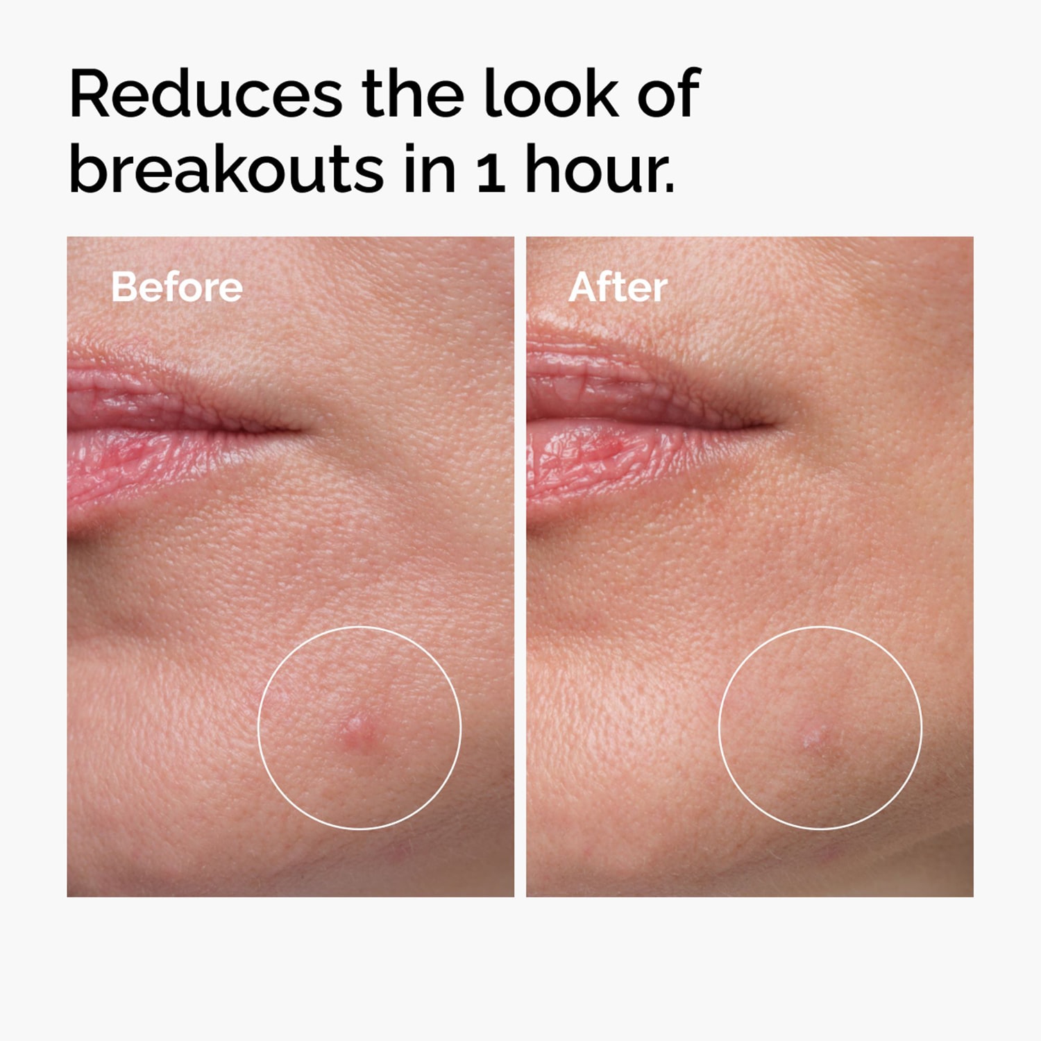 Sulfur 10% Powder-to-Cream Concentrate