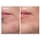 Concentrat crema-pudra cu  10 % sulf - produs de ingrijire a imperfectiunilor