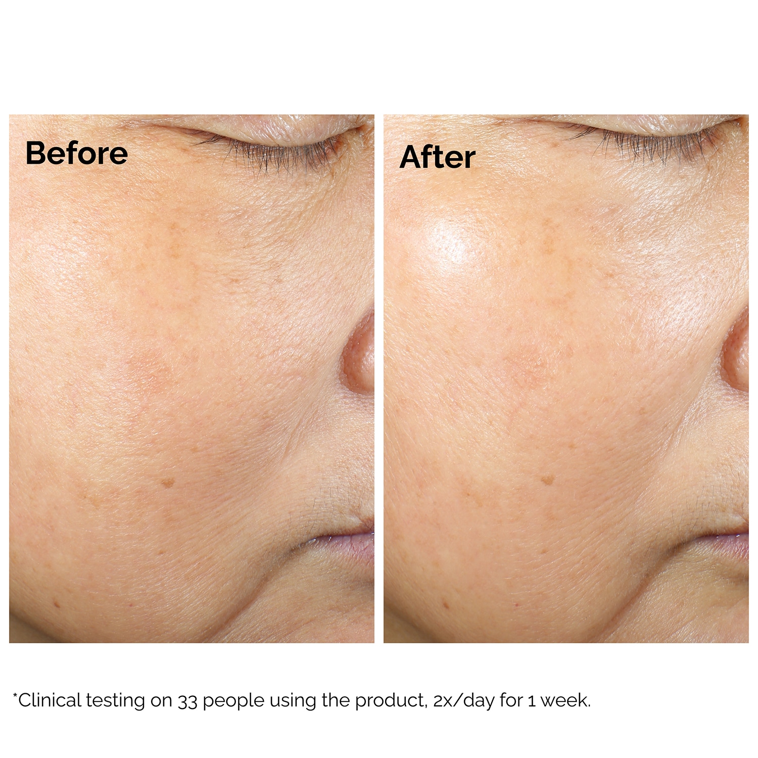 Rice Lipid Microemulsion + Ectoine - Microemulsie hidratanta | The