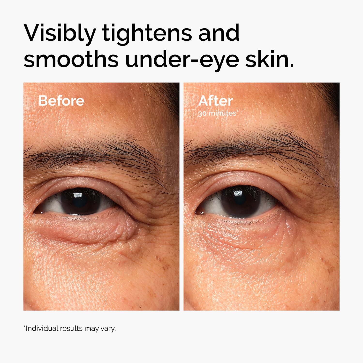 Lacto-PDRN* 4% + B9 Eye Cream