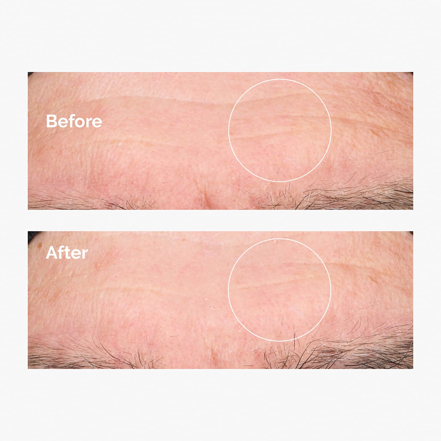 Hyaluronic Acid 2% + B5
