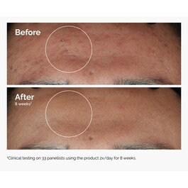 Niacinamid 10% + cink 1% - Serum za lice