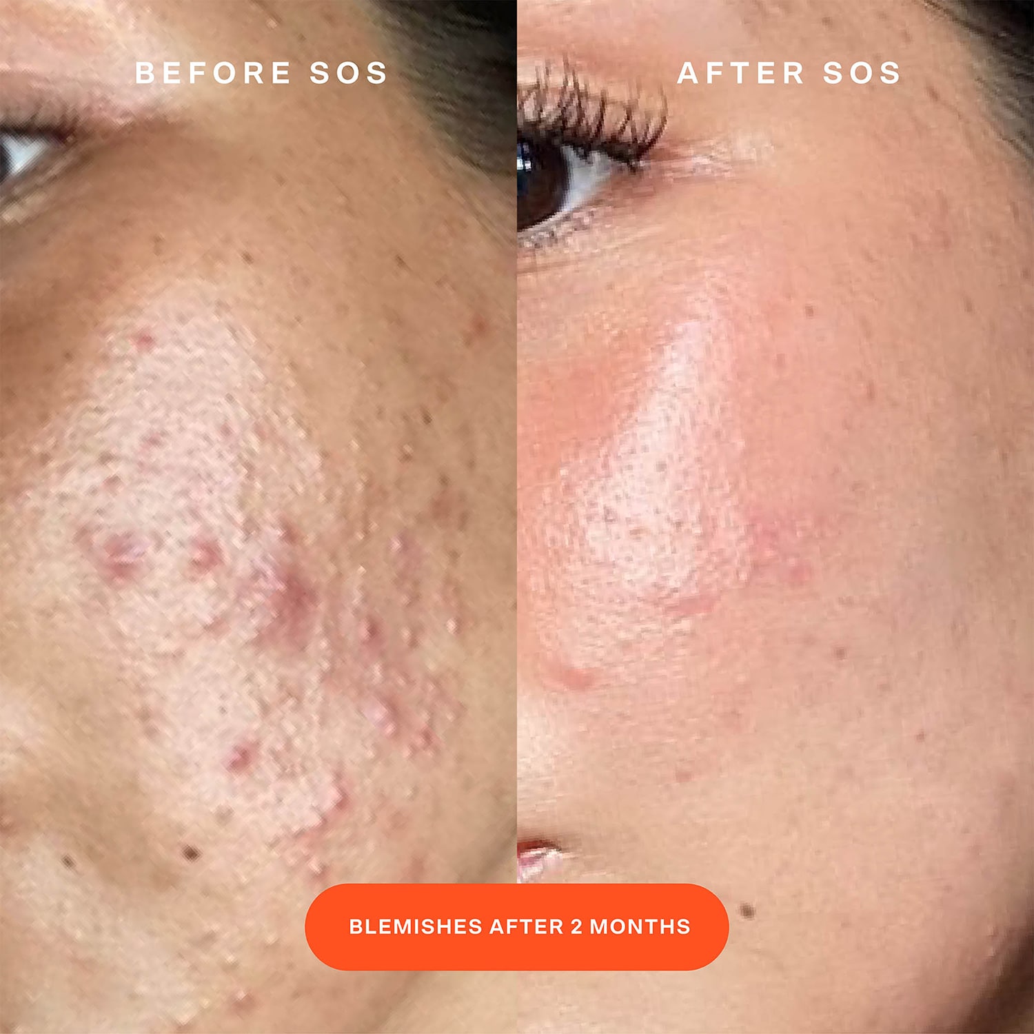 SOS Daily Rescue Facial Spray Refill