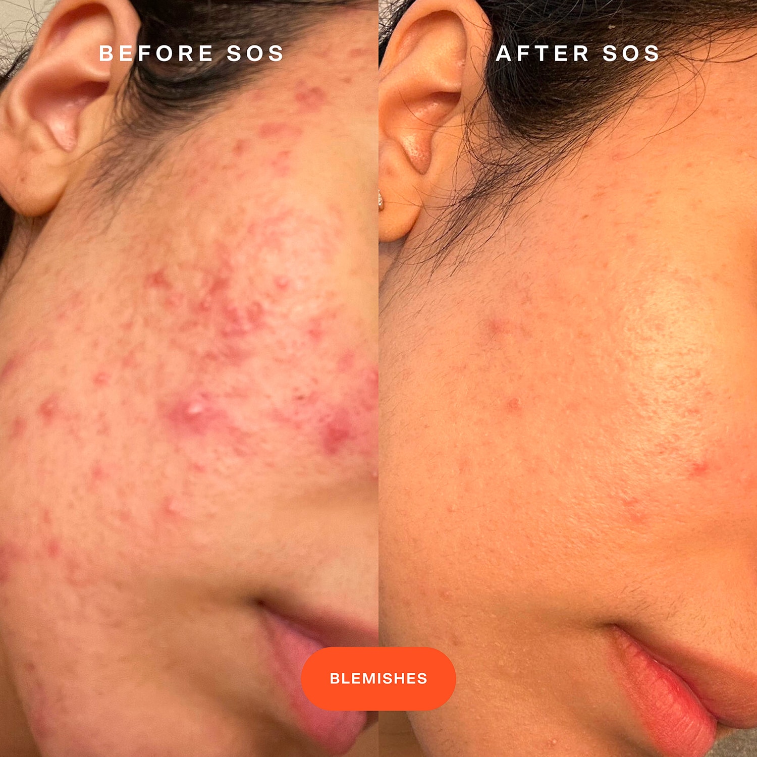 SOS Daily Rescue Facial Spray Refill