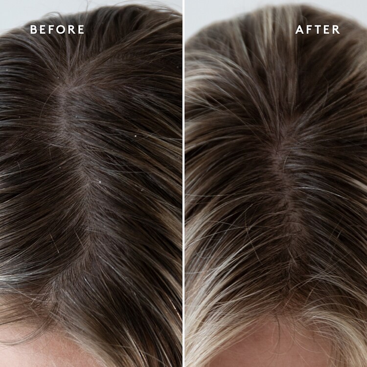 Topical Scalp Supplement - Sérum Cuero Cabelludo